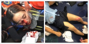 暴力升級 警遭燃燒彈燒傷 女子爆眼球恐失明