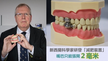 新西蘭科學家研發「減肥裝置」：嘴巴只能張開2毫米