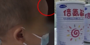 固體飲料冒充醫學奶粉 湖南幼童飲用後變「大頭娃娃」