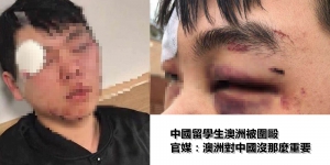 中國留學生被毆　官媒：澳洲對中國沒那麼重要