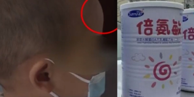 固體飲料冒充醫學奶粉 湖南幼童飲用後變「大頭娃娃」