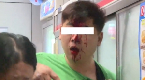 尚德邨男子疑指罵示威者  遭黑衣人以竹支撃頭浴血