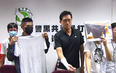 林卓廷要追究白衣施襲者的民事及刑事責任